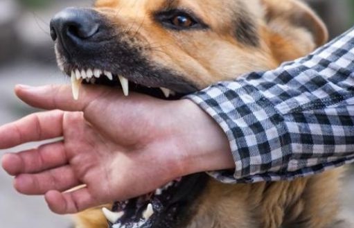 狗狗竟然也会咬主人?是别有用心还是…